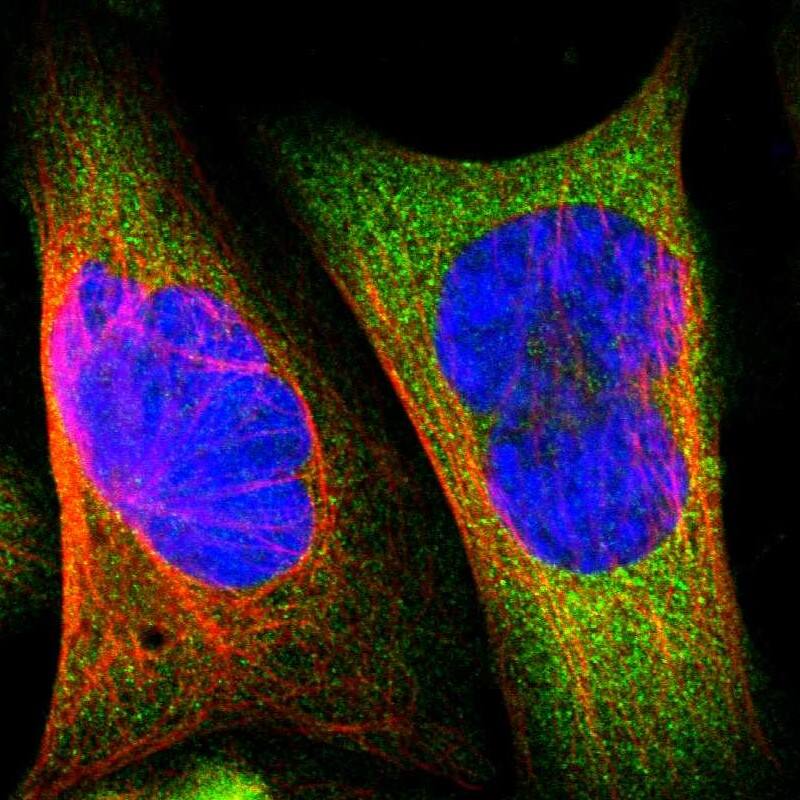 Staining of human cell line U-2 OS shows localization to cytosol.