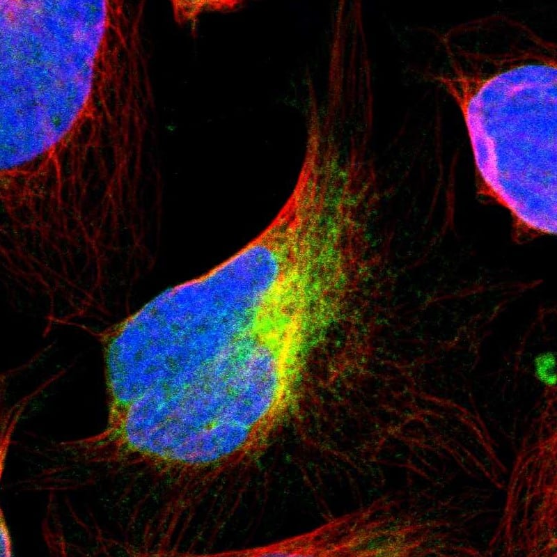 Staining of human cell line U-2 OS shows positivity in endoplasmic reticulum.