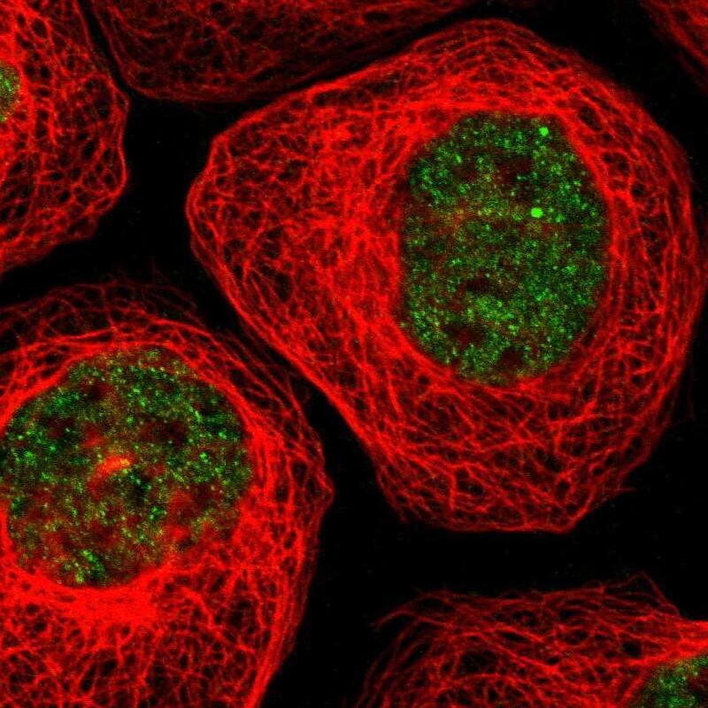 Staining of human cell line A-431 shows localization to nucleoplasm.