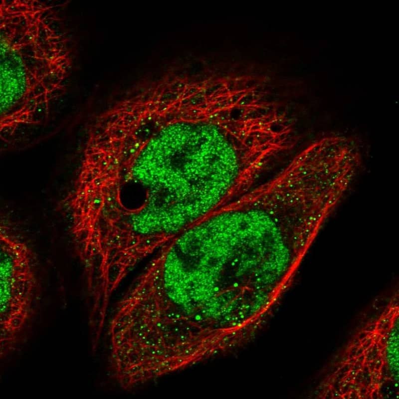 Staining of human cell line A-431 shows localization to nucleoplasm.