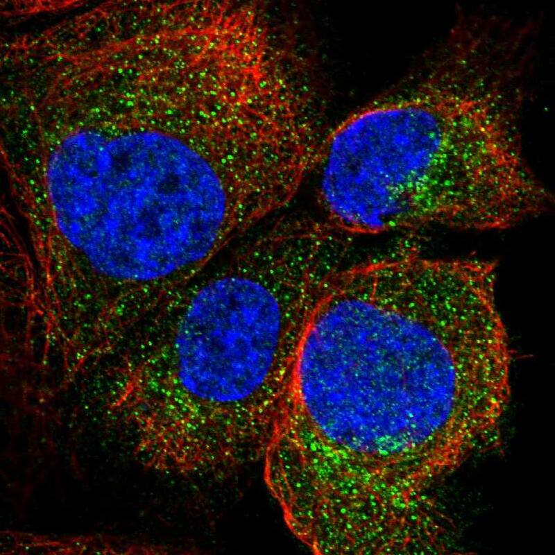 Staining of human cell line A-431 shows localization to cytosol.