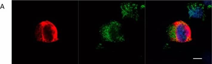 Immunocytochemistry/ Immunofluorescence: FCRN/FCGRT Antibody [NBP1-89128] - FcRn localization in air–liquid interface culture of human nasal epithelial cells on day 21. Cells were co-immunolabeled for FcRn (green) & (A) a basal cell marker, cytokeratin-14 (red), or (B) a goblet cell marker, mucin-5AC (red), or (C) a ciliated cell marker, acetylated  alpha -tubulin (red); & imaged by confocal microscopy. White scale bars represent 5 μm. Image collected & cropped by CiteAb from the following publication (//pubmed.ncbi.nlm.nih.gov/30893823), licensed under a CC-BY license. Not internally tested by Novus Biologicals.