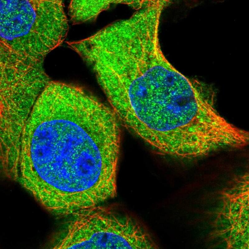 Staining of human cell line A-431 shows localization to nucleoplasm & cytosol.