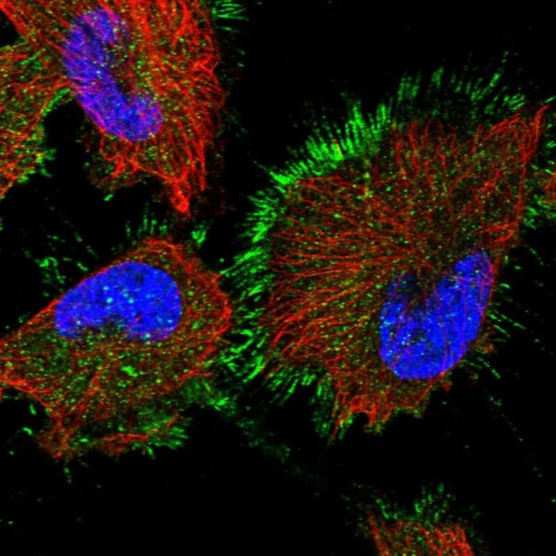 Staining of human cell line U-251 MG shows localization to plasma membrane.
