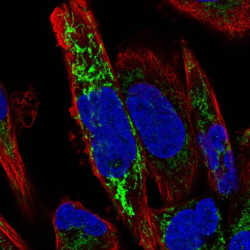 Staining of human cell line RH-30 shows localization to mitochondria.