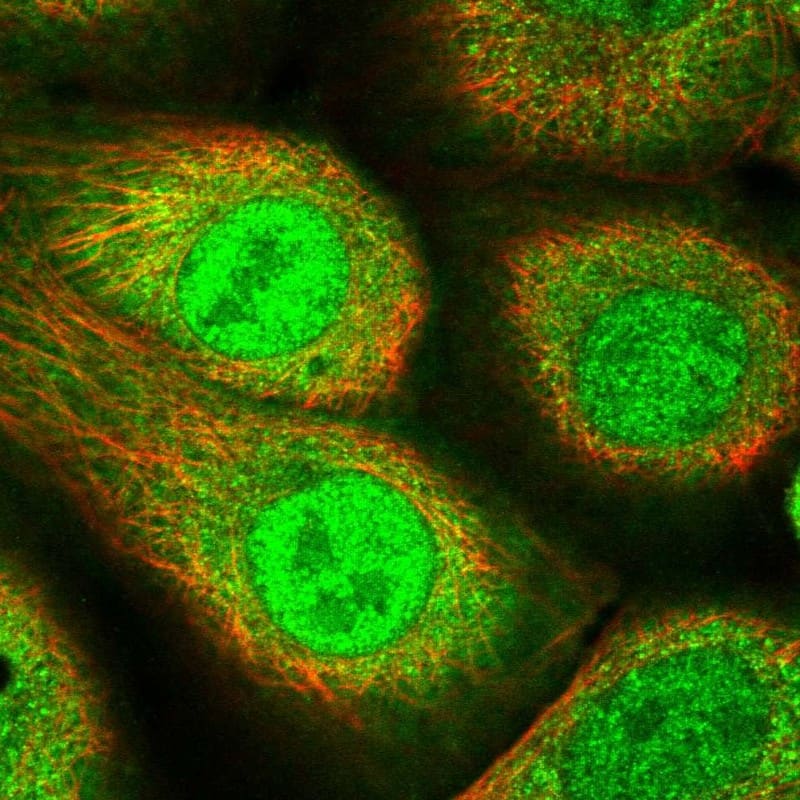 Staining of human cell line A-431 shows localization to nucleoplasm & cytosol.