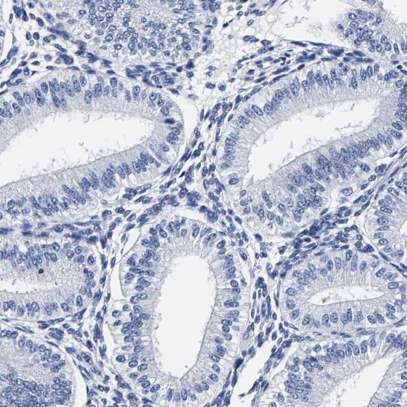 Staining of human endometrium shows no cytoplasmic positivity in glandular cells as expected.