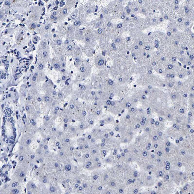 Staining of human liver shows no cytoplasmic positivity in hepatocytes as expected.