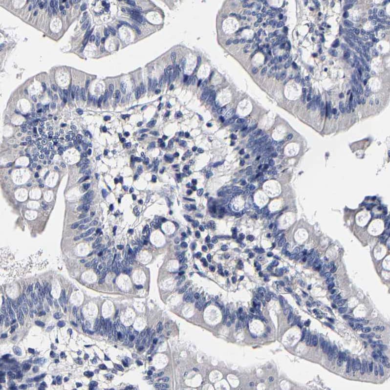 Staining of human small intestine shows no cytoplasmic positivity in glandular cells as expected.