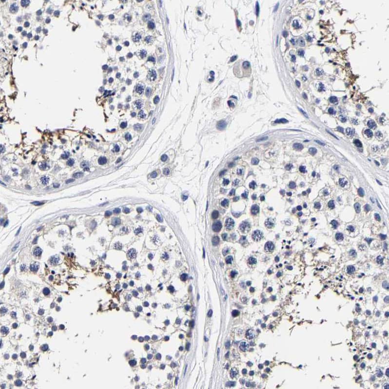 Staining of human testis shows strong cytoplasmic positivity in spermatids.