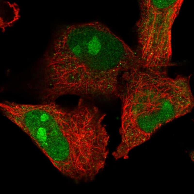 Immunocytochemistry/ Immunofluorescence ZFAND2B Antibody - BSA Free