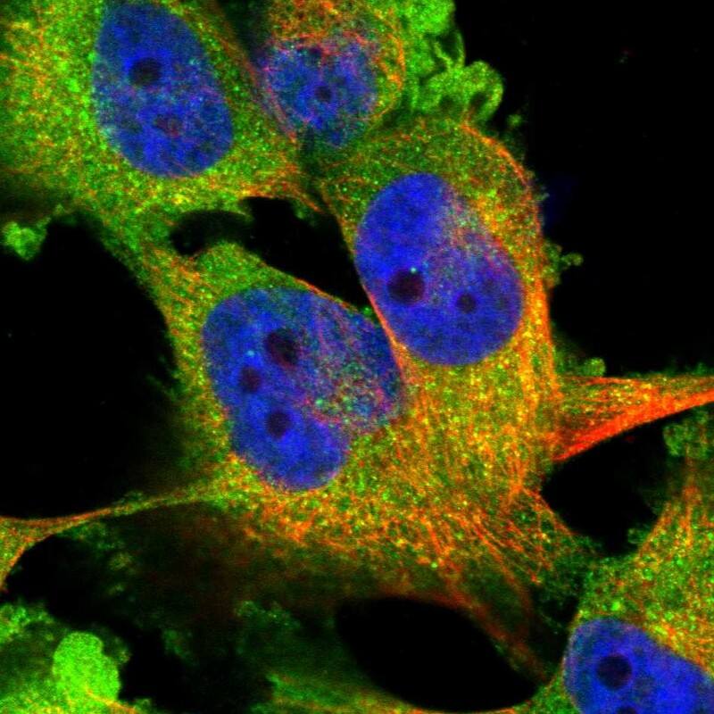 Staining of human cell line U-251 MG shows localization to plasma membrane & cytosol.