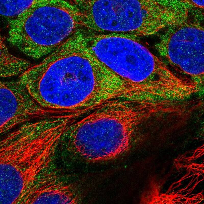 Staining of human cell line CACO-2 shows localization to cytosol.