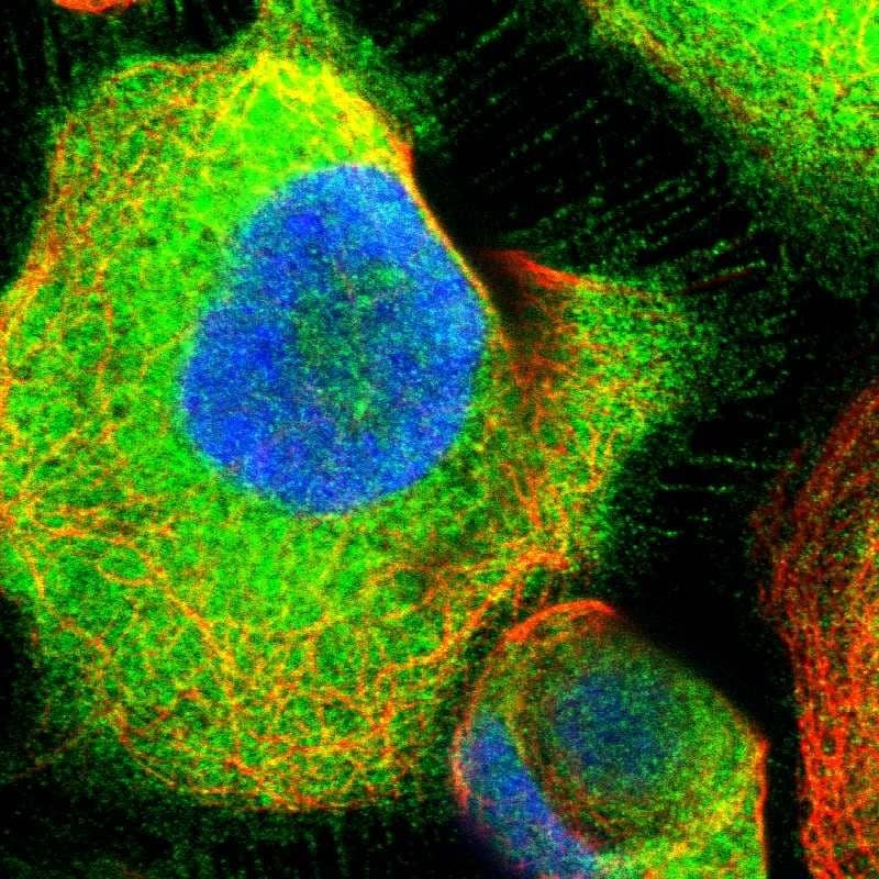 Staining of human cell line A-431 shows positivity in plasma membrane & cytoplasm.