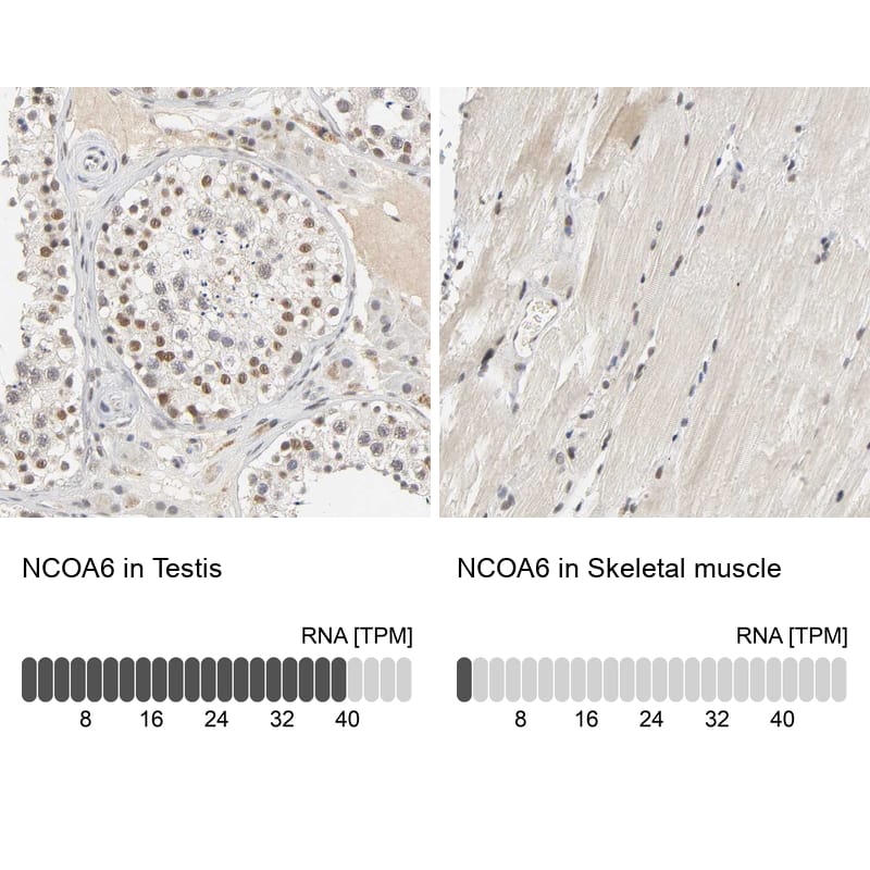<b>Orthogonal Strategies Validation. </b>Analysis in human testis and skeletal muscle tissues. Corresponding RNA-seq data are presented for the same tissues.