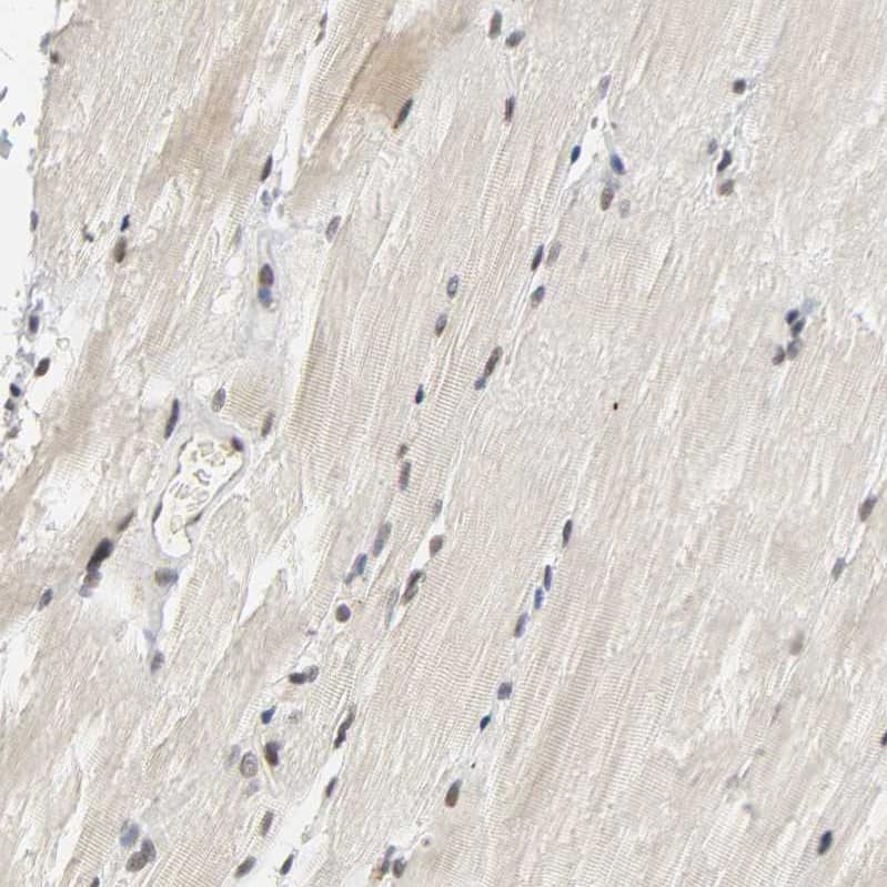 Staining of human skeletal muscle shows weak nuclear positivity in myocytes.