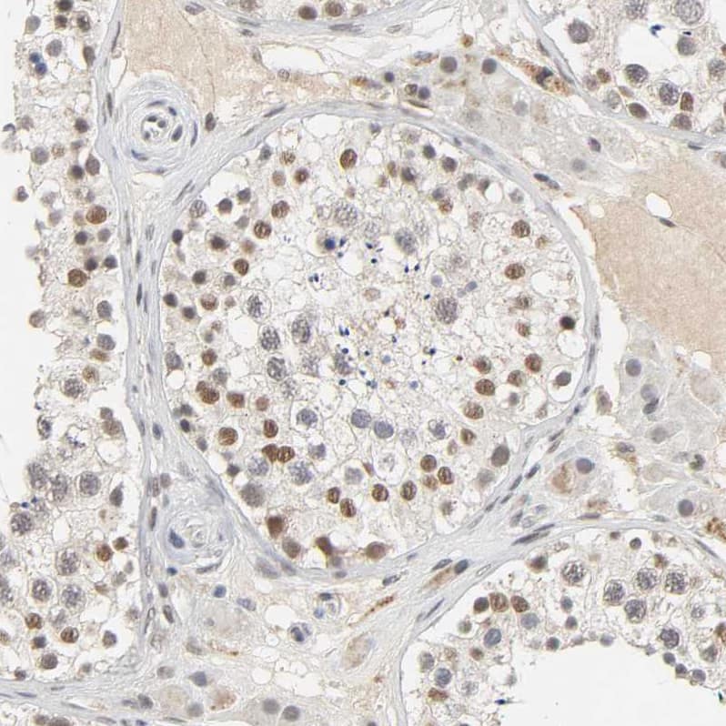 Staining of human testis shows moderate to strong nuclear positivity in cells in seminiferous ducts.