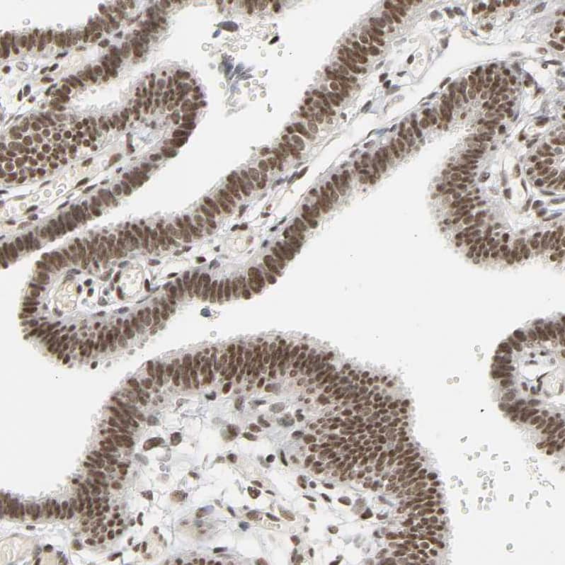 Staining of human fallopian tube shows moderate to strong nuclear positivity in glandular cells.