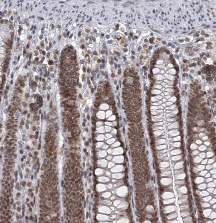 Staining of human colon shows strong nuclear positivity in glandular cells.