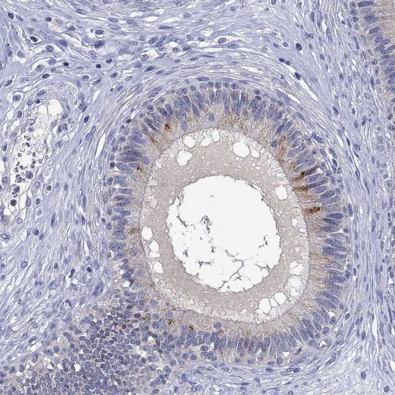 Staining of human epididymis shows strong cytoplasmic positivity in a subset of glandular cells.