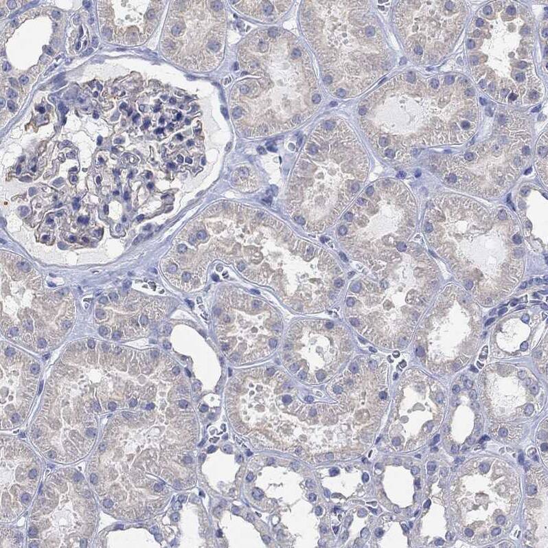 Staining of human kidney shows weak cytoplasmic positivity in cells in tubules.