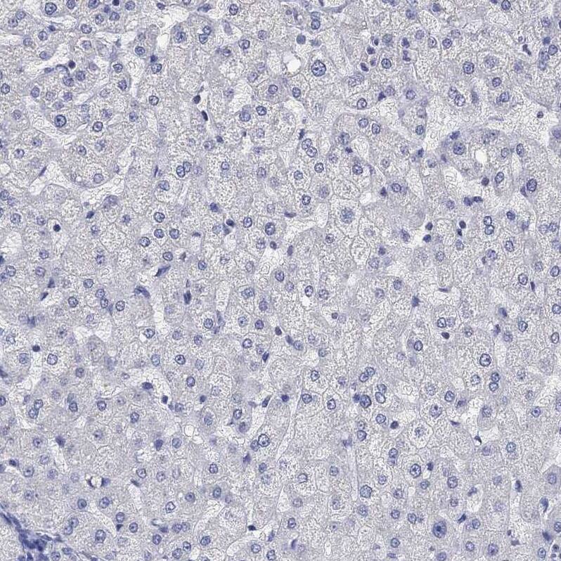 Staining of human liver shows no positivity in hepatocytes as expected.