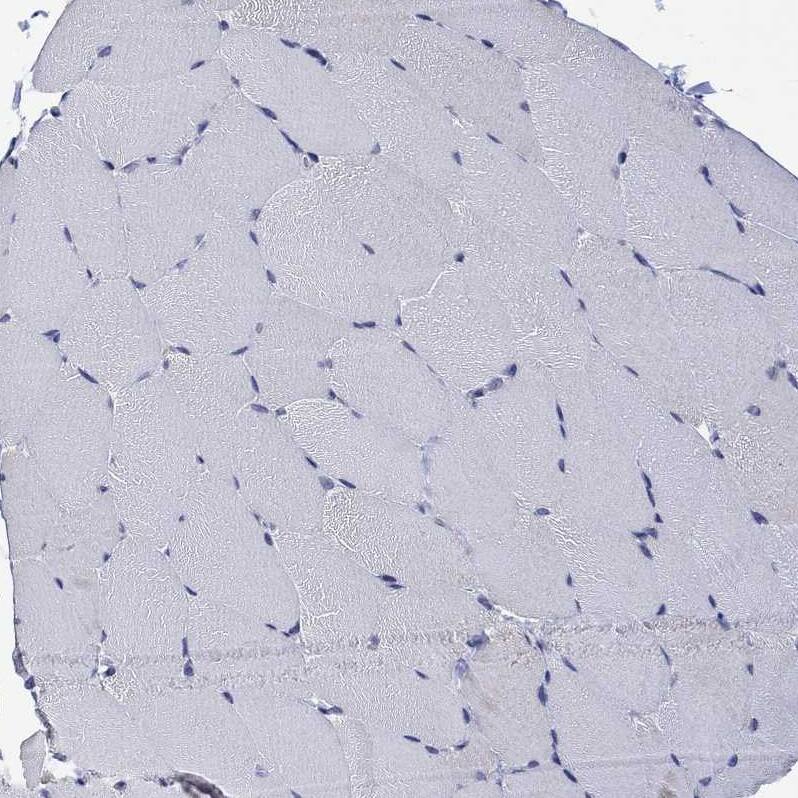 Staining of human skeletal muscle shows no positivity in myocytes as expected.