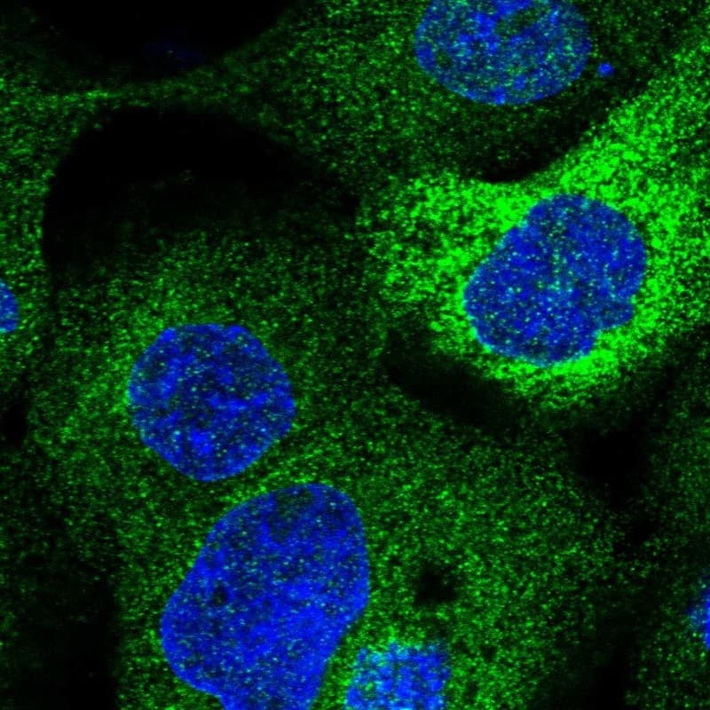 Staining of human cell line A-431 shows localization to endoplasmic reticulum.