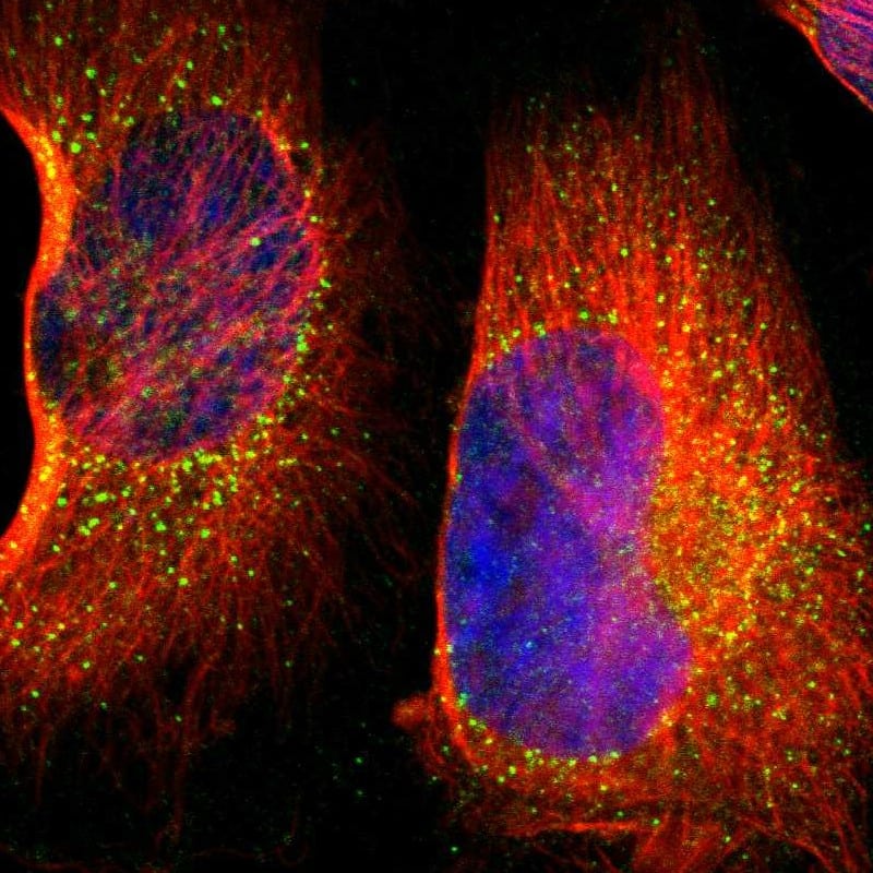 Staining of human cell line U-251 MG shows localization to vesicles.