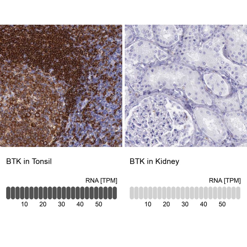 Analysis in human tonsil and kidney tissues. Corresponding RNA-seq data are presented for the same tissues.