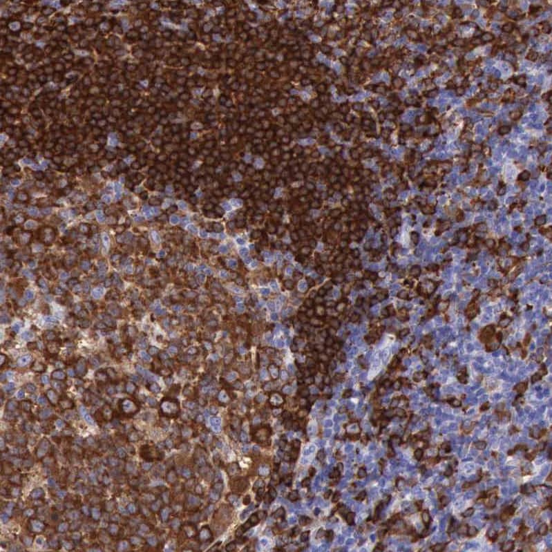 Staining of human tonsil shows strong membranous positivity in non-germinal center cells.