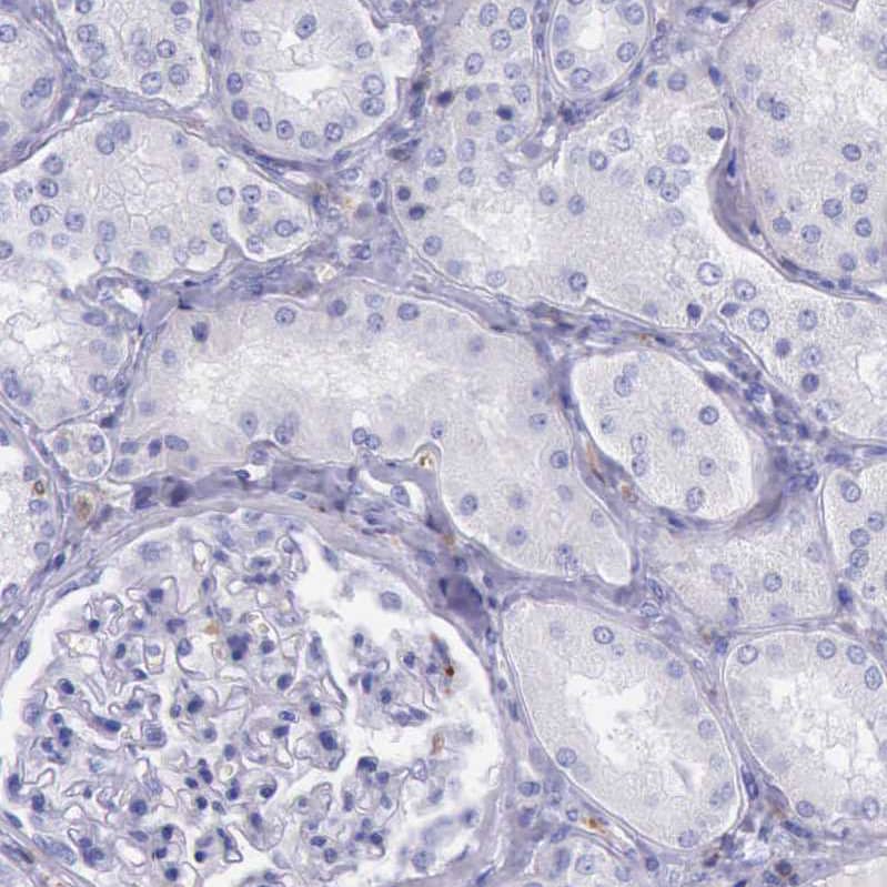 Staining of human kidney shows no positivity in cells in tubules as expected.