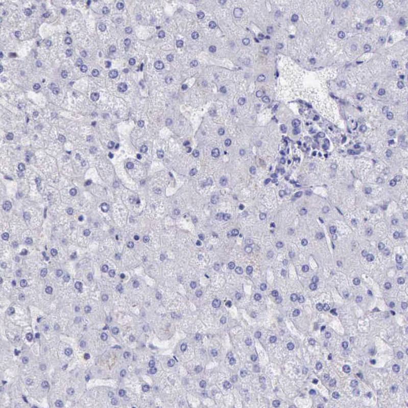 Staining of human liver shows no positivity in hepatocytes as expected.