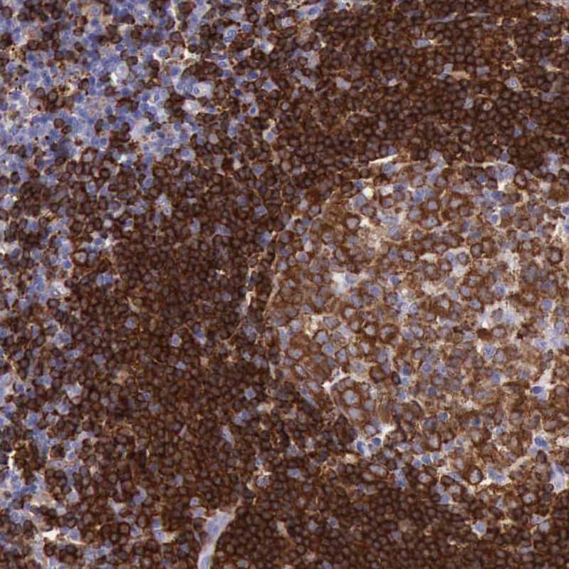 Staining of human lymph node shows strong membranous positivity in non-germinal center cells.