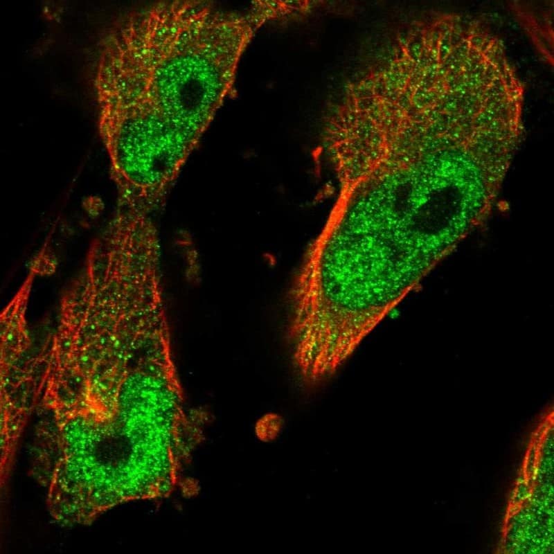 Staining of human cell line U-251 MG shows localization to nucleoplasm & cytosol.
