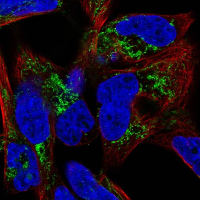 Staining of human cell line RH-30 shows localization to mitochondria.