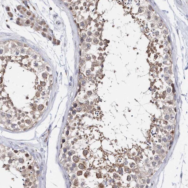 Staining of human testis shows moderate cytopalsmic positivity in cells in seminiferous ducts.