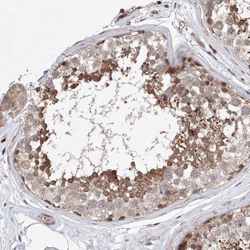 Immunohistochemistry-Paraffin LACE1 Antibody - BSA Free