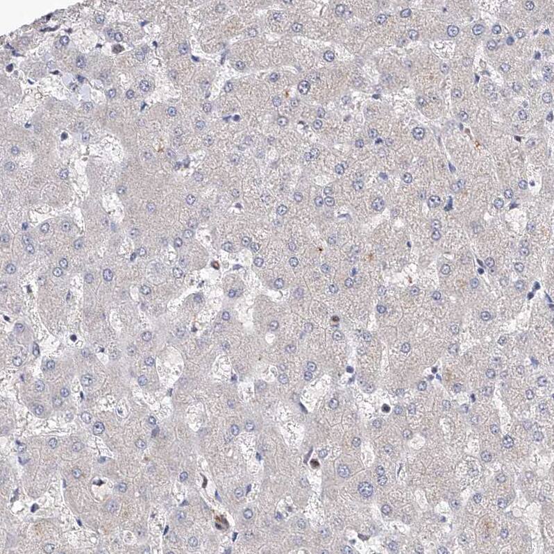 Immunohistochemistry-Paraffin LACE1 Antibody - BSA Free