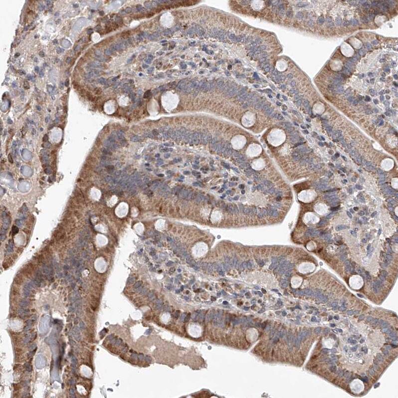 Staining of human duodenum shows moderate granular cytoplasmic positivity in glandular cells.