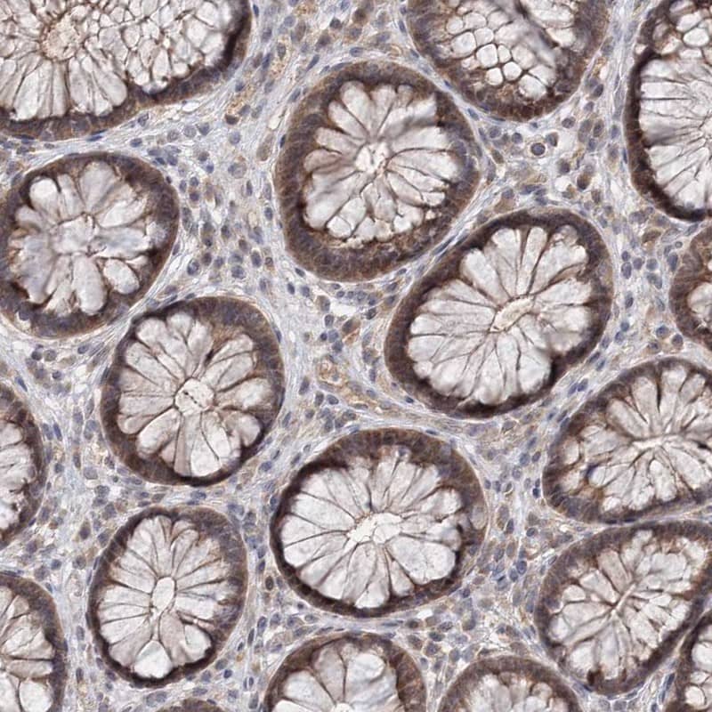 Staining of human rectum shows cytoplasmic positivity in glandular cells.