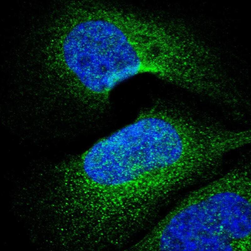 Staining of human cell line U-2 OS shows localization to cytosol.