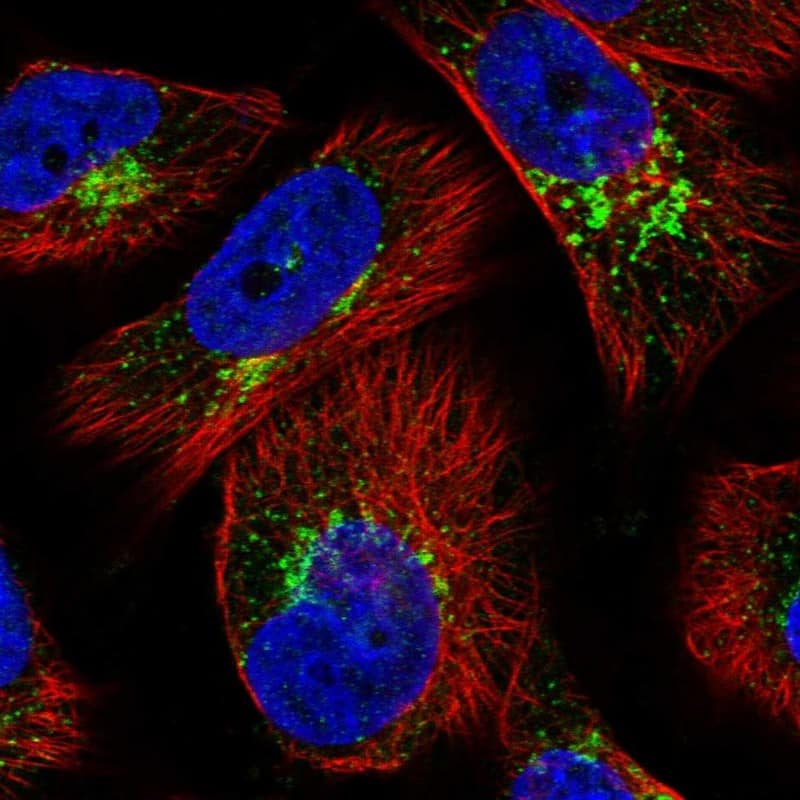Immunocytochemistry/ Immunofluorescence WDTC1 Antibody - BSA Free