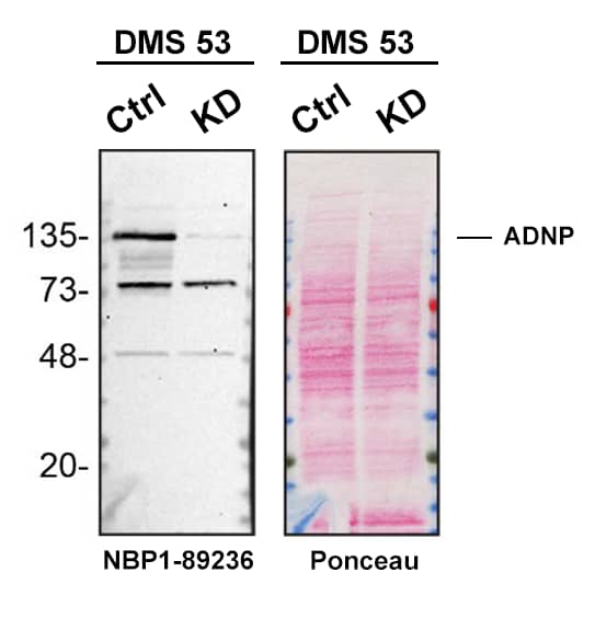 Western blot shows lysates of DMS 53 parental cell line and ADNP knockdown DMS 53 cell line (KD). Nitrocellulose membrane was probed with ADNP Antibody (Catalog # NBP1-89236) followed by HRP-conjugated secondary antibody. A specific band was detected for ADNP at approximately 135 kDa (as indicated) in the parental DMS 53 cell line, but is significantly reduced in knockdown DMS 53 cell line. Primary antibody concentration used: 0.4 μg/ml. The Ponceau stained transfer of the blot is shown. This experiment was conducted under reducing conditions. Image, protocol, and testing courtesy of YCharOS Inc. See ycharos.com for additional details.