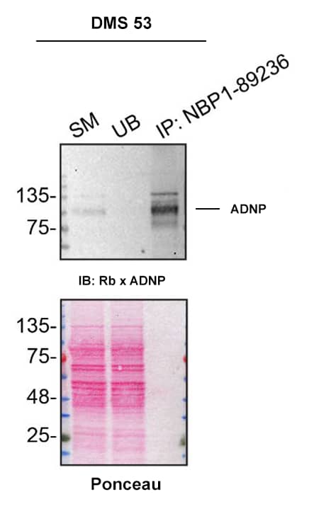 DMS 53 cell line lysates were prepared and immunoprecipitation was performed using 2.0 μg of ADNP Antibody (Catalog # NBP1-89236) pre-coupled to Dynabeads Protein A. Immunoprecipitated ADNP was detected in Western Blot with a Rabbit ADNP antibody used at 1/500. The Ponceau stained transfer of the blot is shown. SM=4% starting material; UB=4% unbound fraction; IP=immunoprecipitate; HC=antibody heavy chain. Image, protocol and testing courtesy of YCharOS Inc. (ycharos.com).