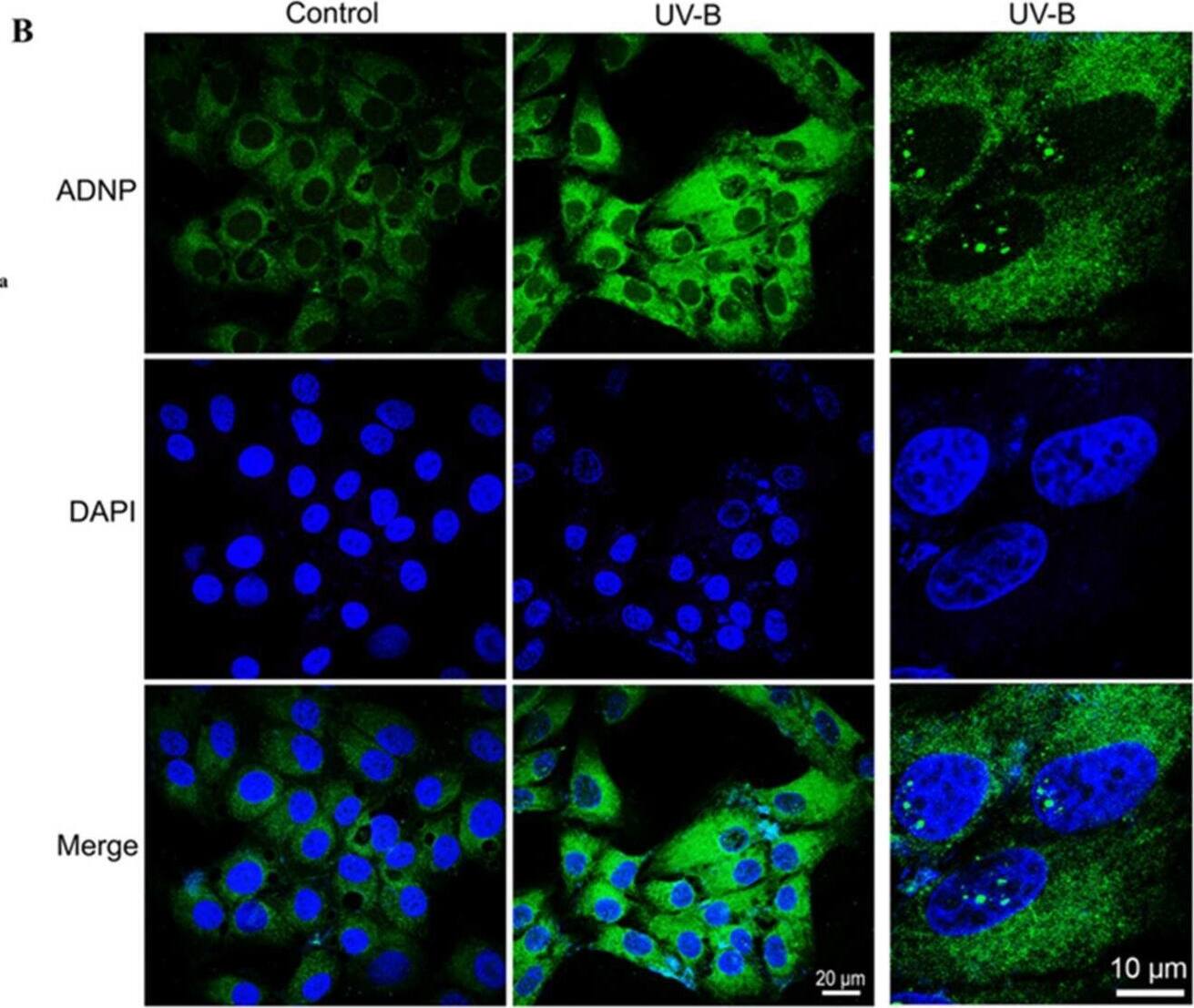 Expression of ADNP in SIRC cells exposed to UV-B radiations. (A) Representative immunoblots of ADNP expression in SIRC cells following exposure to UV-B insult. The bar graph shows quantitative analysis of signals obtained by immunoblots resulting from three independent experiments. Relative band densities were quantified using ImageJ software. Protein levels are expressed as arbitrary units obtained following normalization to b-tubulin, which was used as loading control. Data represent means +/- SEM. *** p < 0.001 vs. CTRL, as determined by unpaired two-tailed Student t-test. (B) Representative photomicrographs showing ADNP expression (green) in SIRC cells exposed to UV-B radiations. Nuclei were stained with DAPI. Photomicrographs are representative results of fields taken randomly from each slide and scanned by confocal laser scanning microscopy (CLSM; Zeiss LSM700). In the right column, a thin section (0.3 um) with some SIRC cells showing ADNP in the euchromatic compartment of the nuclei is shown. Scale bar in the left and middle columns is 20 μm, and in the right column is 10 μm. Image collected and cropped by CiteAb from the following open publication (//pubmed.ncbi.nlm.nih.gov/35052632), licensed under a CC-BY license. Not internally tested by Novus Biologicals.