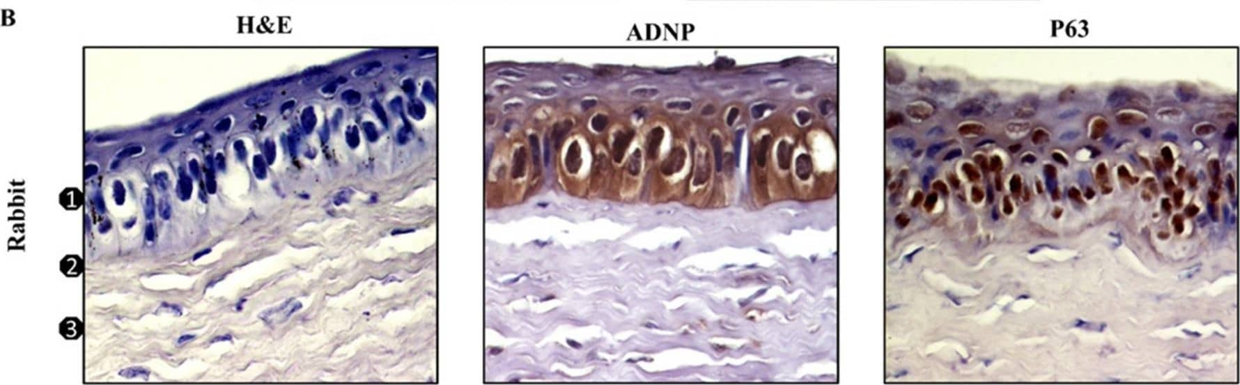 Expression of ADNP and p63 in corneal epithelium. H&E staining and immunodetection of ADNP and p63 in human (A) and rabbit (B) cornea: (1) Epithelium, (2) Bowman’s membrane, (3) stroma. Original magnification ×200. Digital micrographs are representative results of fields taken in randomly selected slides and obtained using the Zeiss Axioplan light microscope (Carl Zeiss) fitted with a digital camera (AxioCam MRc5; Carl Zeiss); scale bar: 20 μm. Image collected and cropped by CiteAb from the following open publication (//pubmed.ncbi.nlm.nih.gov/35052632), licensed under a CC-BY license. Not internally tested by Novus Biologicals.