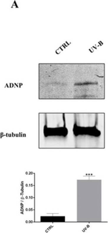 Expression of ADNP in SIRC cells exposed to UV-B radiations. (A) Representative immunoblots of ADNP expression in SIRC cells following exposure to UV-B insult. The bar graph shows quantitative analysis of signals obtained by immunoblots resulting from three independent experiments. Relative band densities were quantified using ImageJ software. Protein levels are expressed as arbitrary units obtained following normalization to b-tubulin, which was used as loading control. Data represent means +/- SEM. *** p < 0.001 vs. CTRL, as determined by unpaired two-tailed Student t-test. (B) Representative photomicrographs showing ADNP expression (green) in SIRC cells exposed to UV-B radiations. Nuclei were stained with DAPI. Photomicrographs are representative results of fields taken randomly from each slide and scanned by confocal laser scanning microscopy (CLSM; Zeiss LSM700). In the right column, a thin section (0.3 um) with some SIRC cells showing ADNP in the euchromatic compartment of the nuclei is shown. Scale bar in the left and middle columns is 20 μm, and in the right column is 10 μm. Image collected and cropped by CiteAb from the following open publication (//pubmed.ncbi.nlm.nih.gov/35052632), licensed under a CC-BY license. Not internally tested by Novus Biologicals.