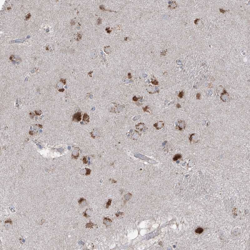 Staining of human caudate shows strong cytoplasmic positivity in neuronal cells.