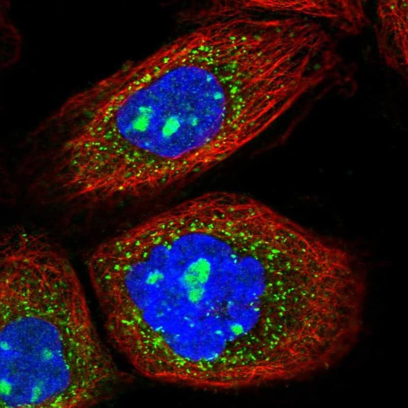 Staining of human cell line A-431 shows localization to nucleoli & peroxisomes.
